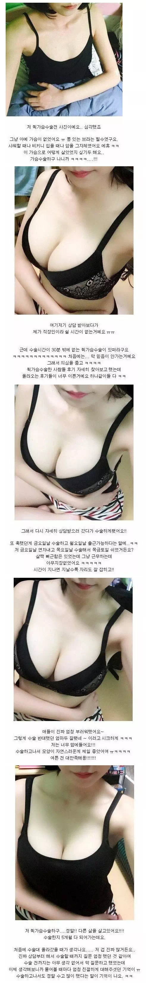 가슴 수술이 왜 중요한지 알려주는;;